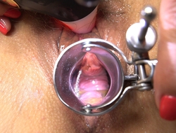 Doctor games! First Orgasm fro a speculum in make an issue of pussy