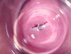 Inside Mia's vagina, internal camera in teen cum-hole